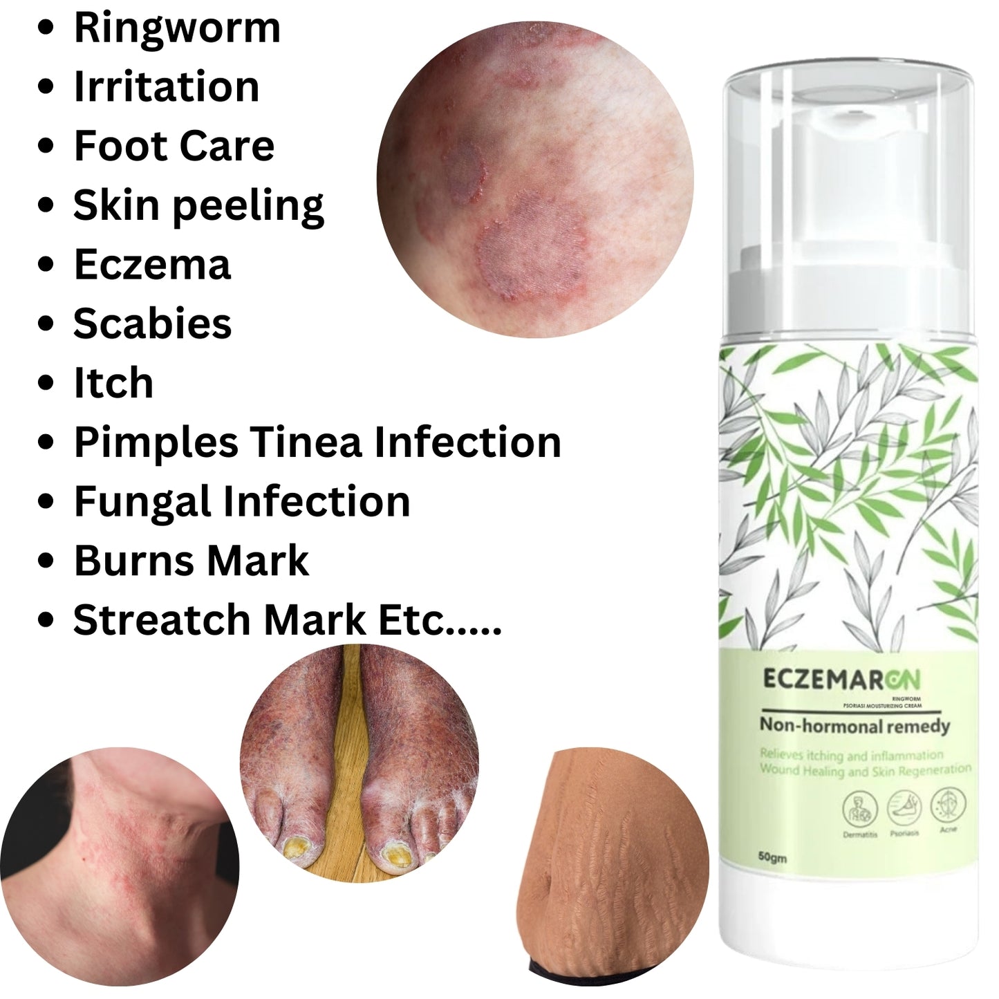 Eczemaron Ringworm Anti Fungal Cream (50gm)