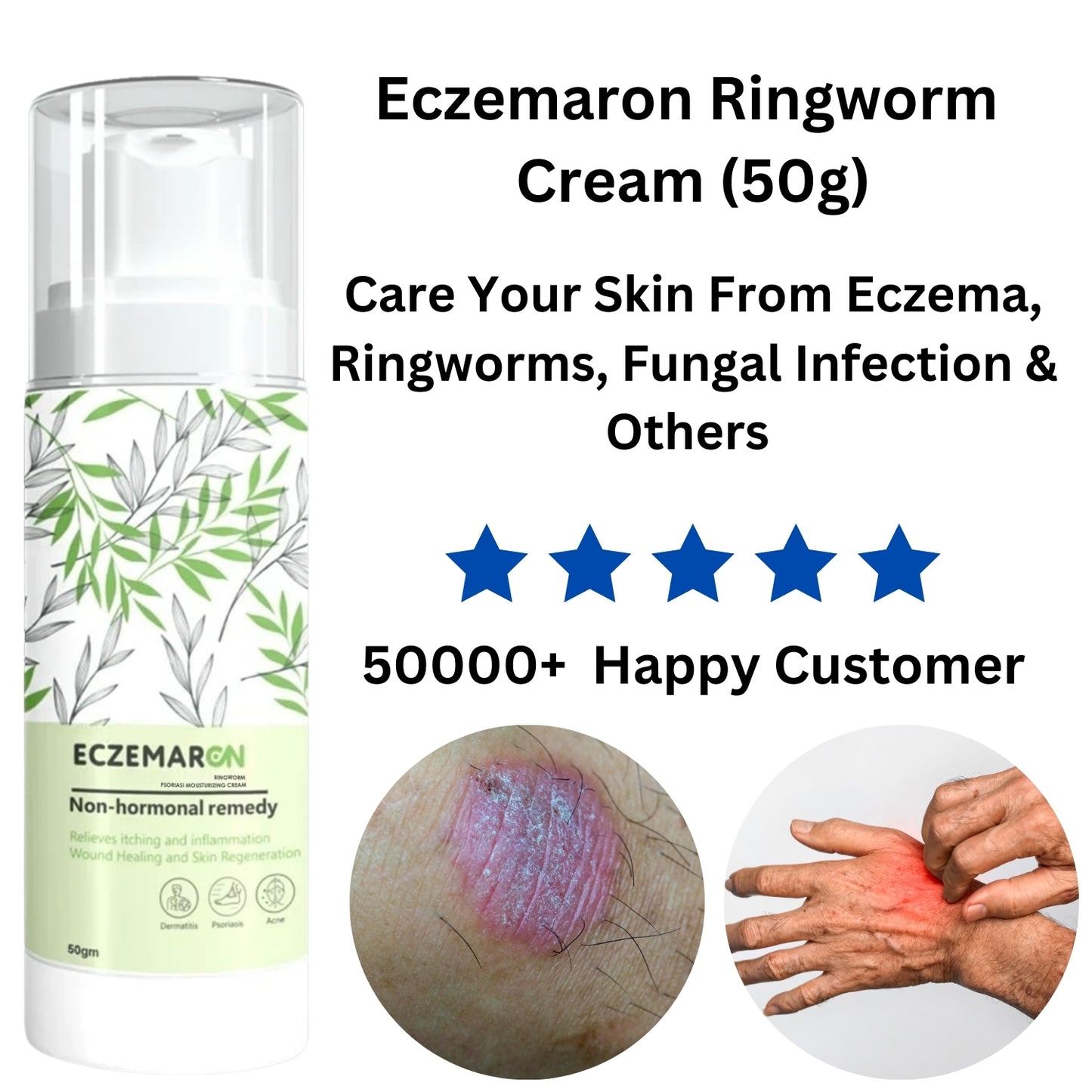 Eczemaron Ringworm Anti Fungal Cream (50gm)